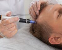 Hair loss medical management course