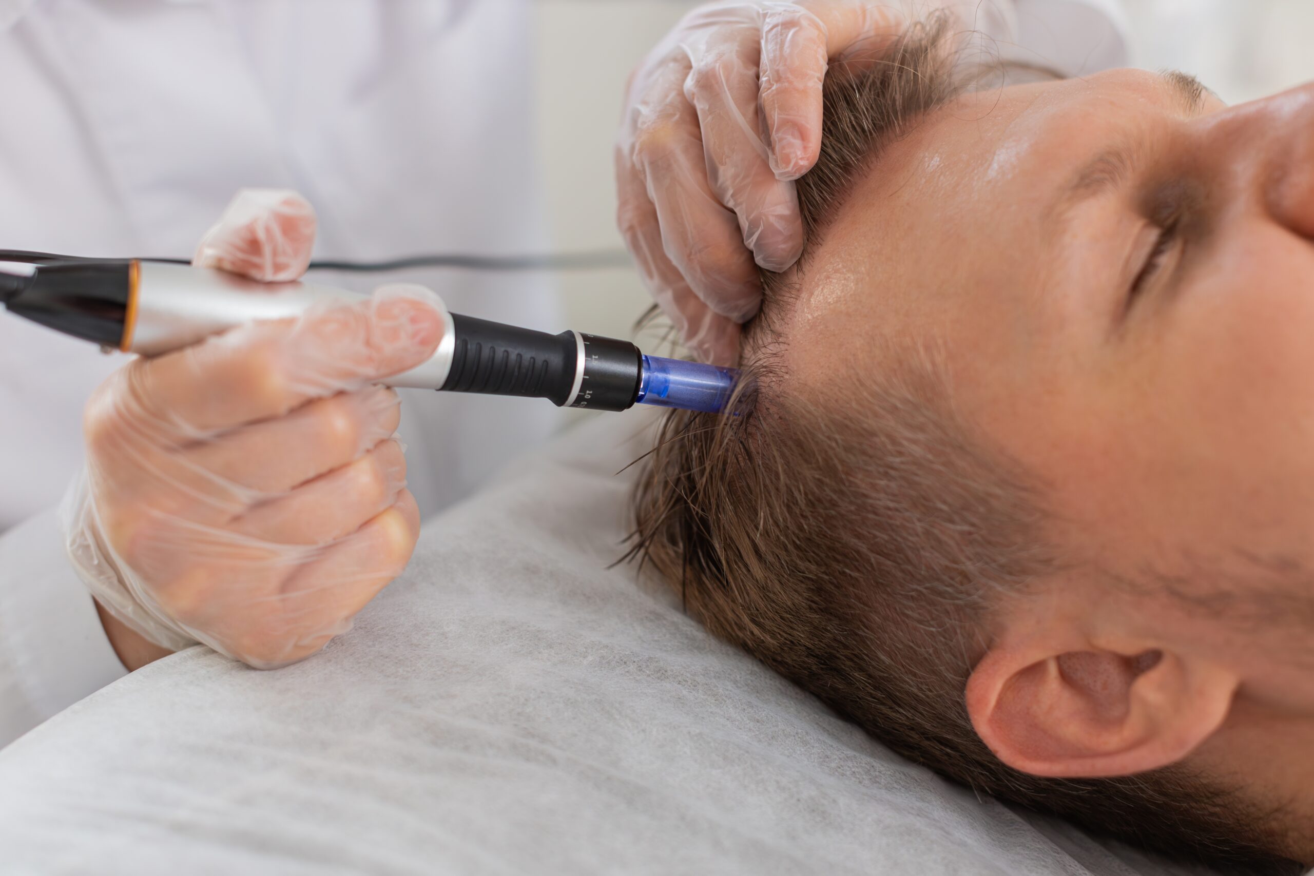 Hair loss medical management course
